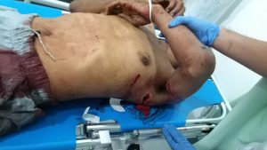 Duel Maut, Nasution Tewas Dikeroyok Duo Chaniago