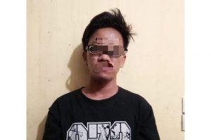 Pria Berkacama Ngaku Mencuri Buat Pengurusan Passport dan Beli Pakaian
