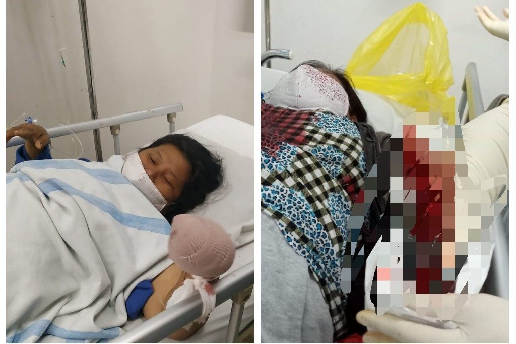 4 Jari Pedagang Cabai Putus Ditebas Kawanan Begal