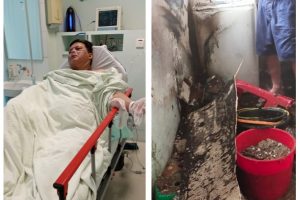 Tabung Gas Meledak, Pasutri Luka Bakar, Dapur Rumah Hangus