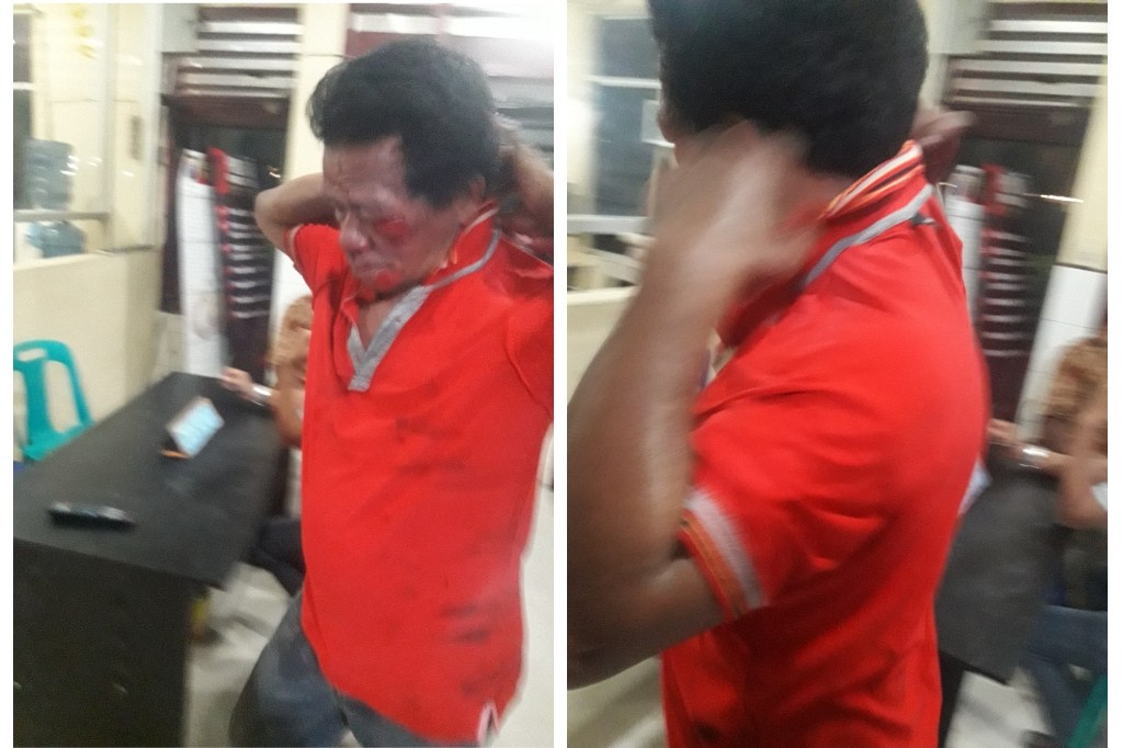 Tegur Pengendara Motor yang Nyerempet Pejalan Kaki, Jukir Ini Malah Bonyok Dipukuli