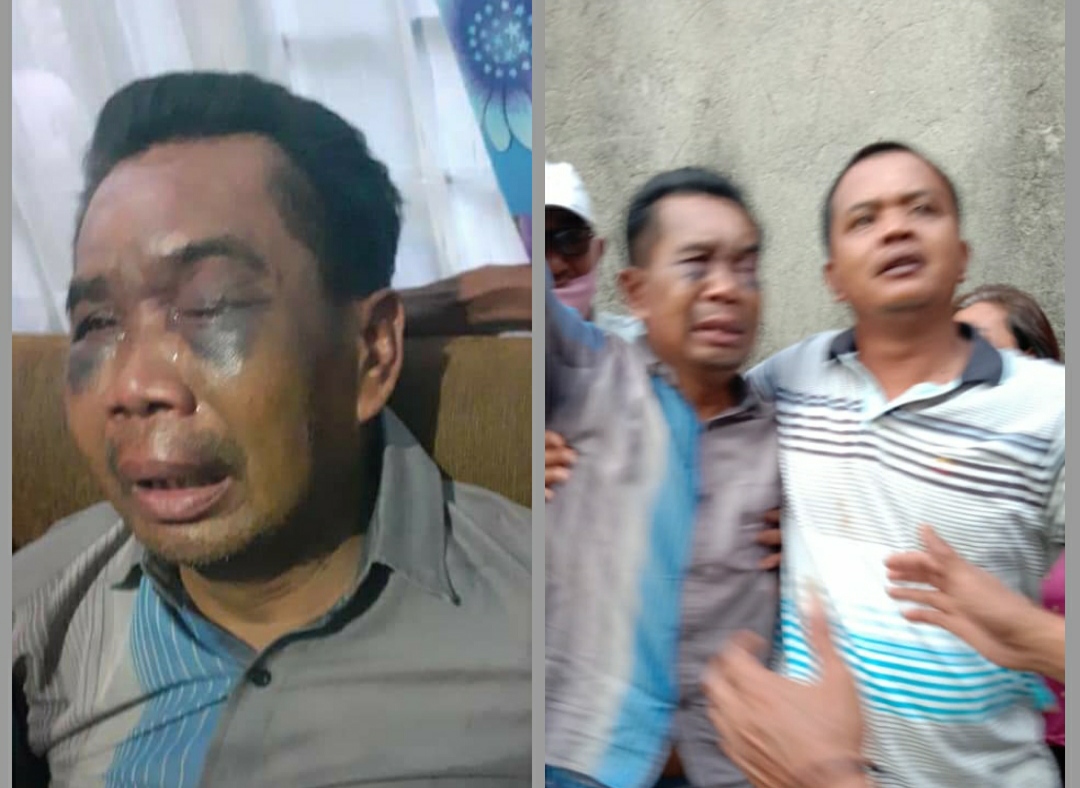 Kasus Tewasnya Dodi Sumanto Akibat Dicangkul Berbuntut Panjang, Ini Kata LBH Medan Soal Sarpan