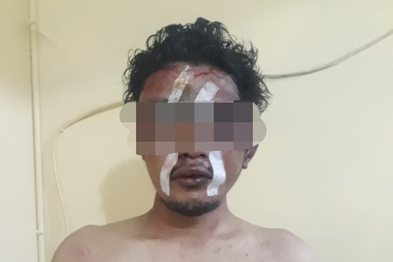 Rasain, Begal Ini Babak Belur Usai Jatuh Dari Motor yang Dicurinya, 3 Temannya Kabur