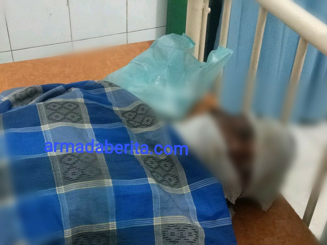 Gegara Lembu, Istri Kedua Bakar Suami, Keduanya Melepuh