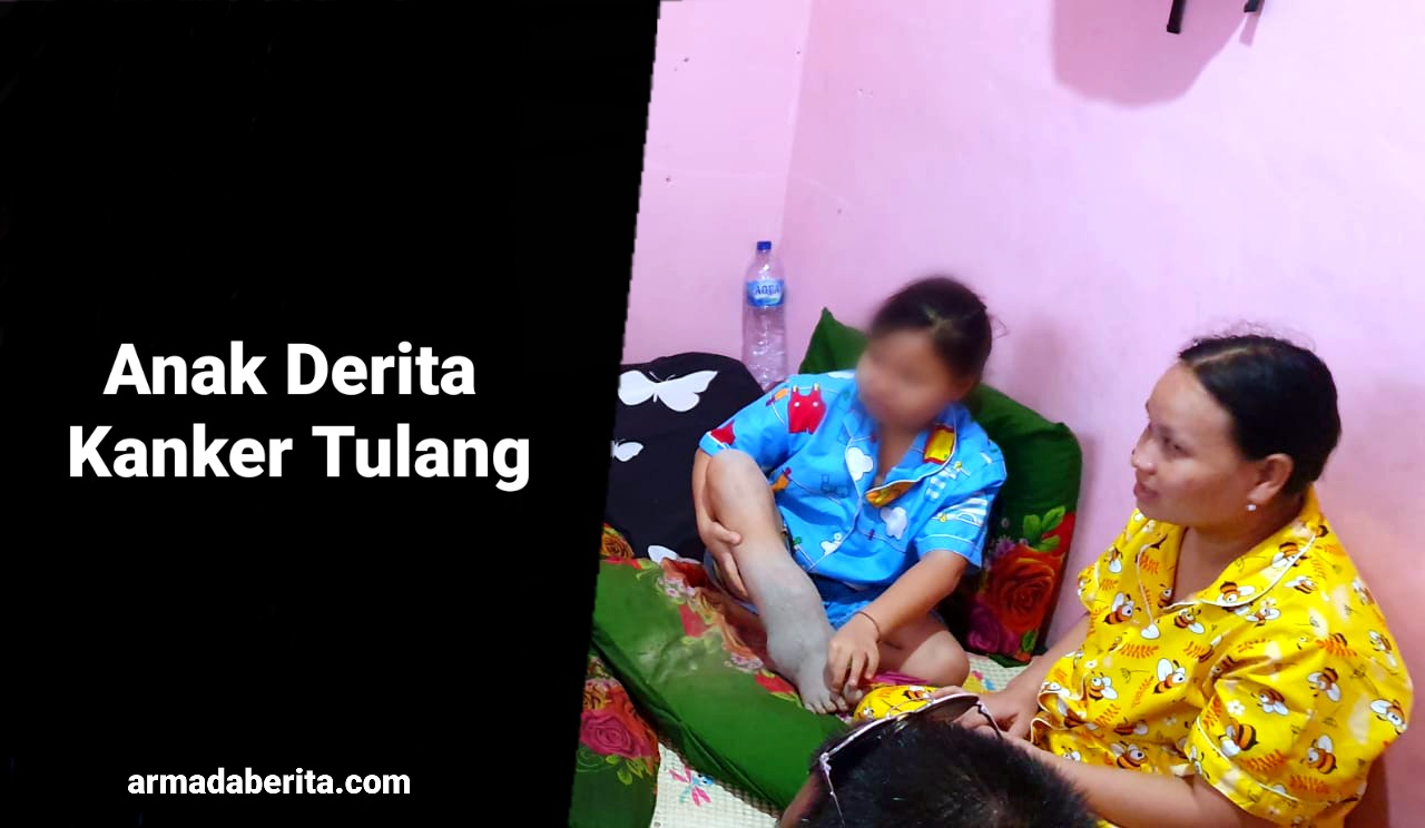 Bocah Perempuan Ini Derita Kanker Tulang