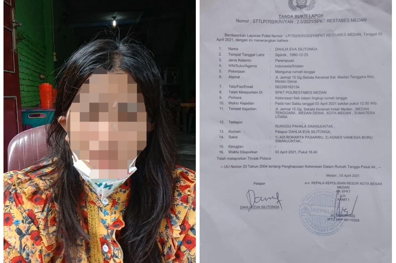 Jadi Tulang Punggung Keluarga, Istri Ngaku Kerap Dianiaya Suami, dan Berujung Laporan Polisi