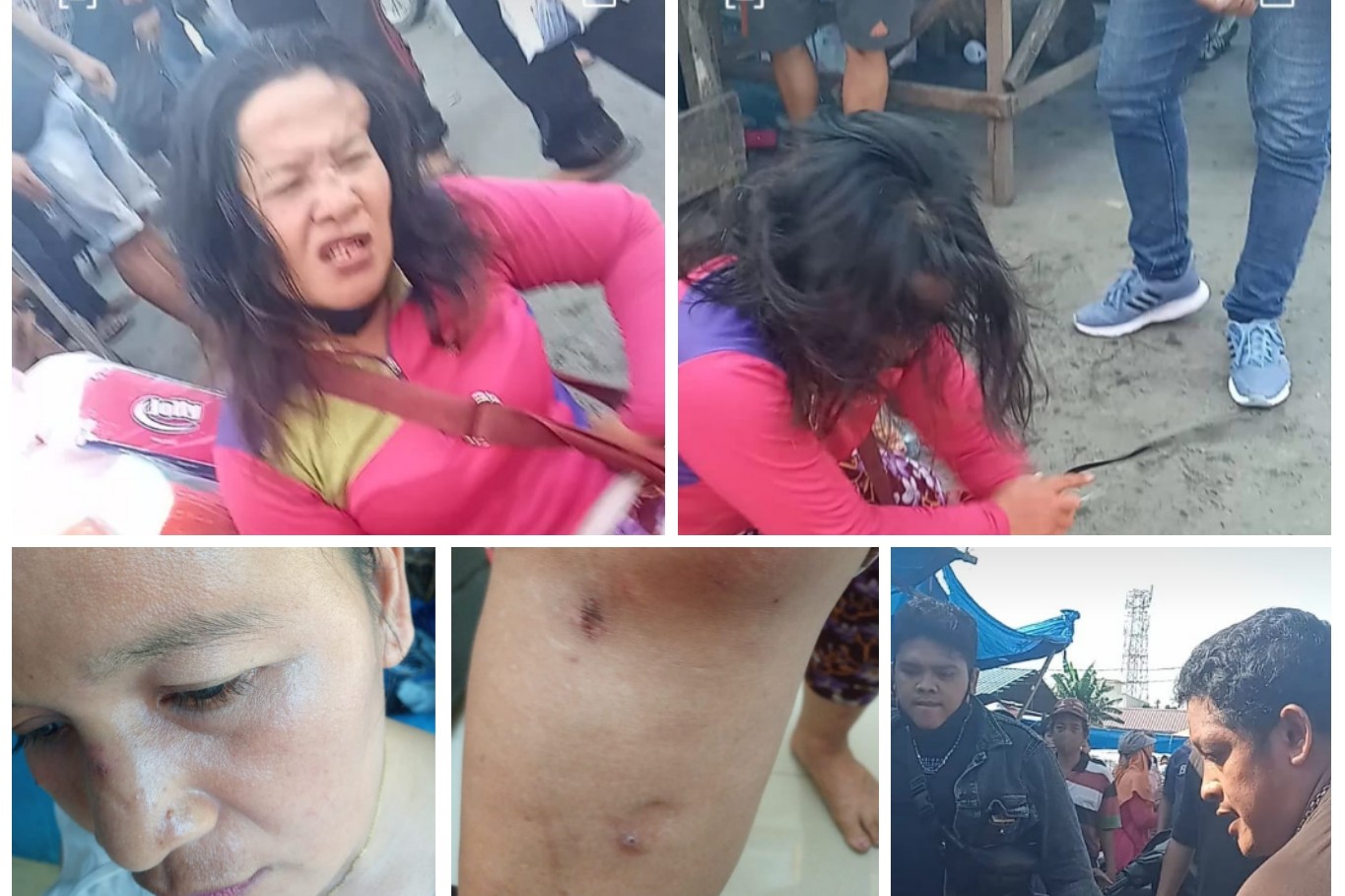 Viral, Ibu Pedagang Cabai dan Anak Perempuannya Dipukuli 4 Preman, Satu Pelaku Ditangkap Polsek Percut