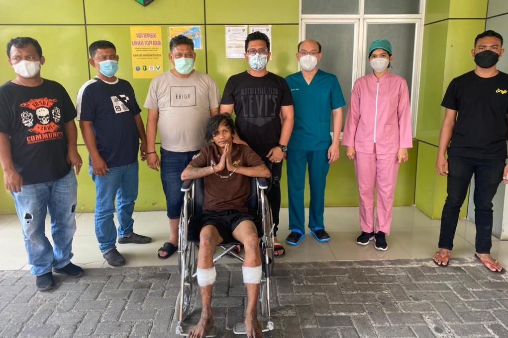 Pencuri Motor di Alam Hotel Medan Ditembak Polisi, Security Ikut Terlibat