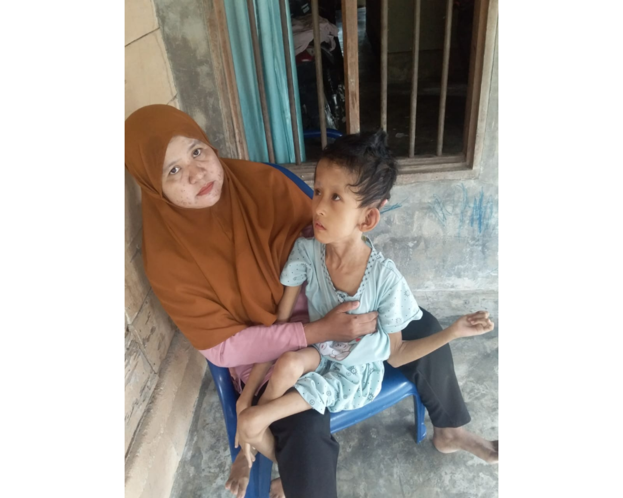 Reses di Besitang, Juriah Anggota DPRD Langkat Didatangi Anak Stunting
