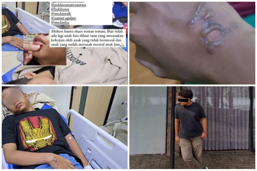 Viral Siswa MAN 1 Medan Korban Bullying 20 Orang Kakak Alumni