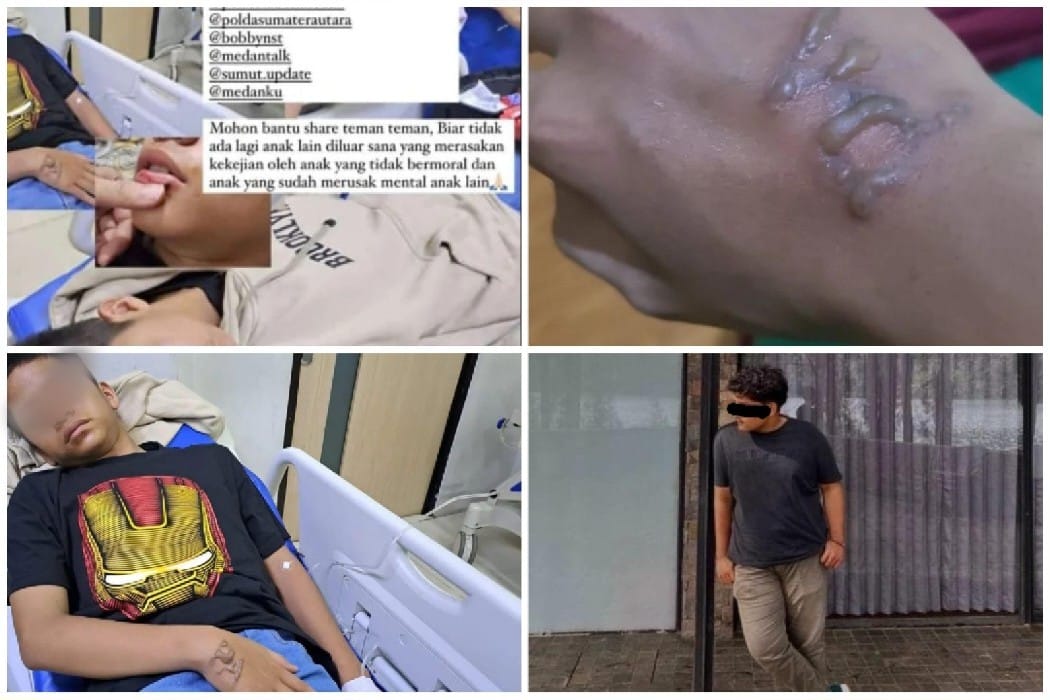Polrestabes Medan Sikat Pelaku Bullying di MAN 1 Medan: Keadilan untuk Korban MH