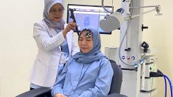 TMS Hadir di RS Adam Malik, Terapi Tanpa Operasi Buka Harapan Baru Pasien Stroke dan Gangguan Mental