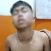 Remaja 16 Tahun Dibacok saat Melintas di Perumnas Mandala, Diduga Jadi Korban Salah Sasaran Tawuran