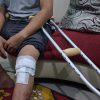 Sepasang Kruk dan Jalan Pulang Ke Lapangan